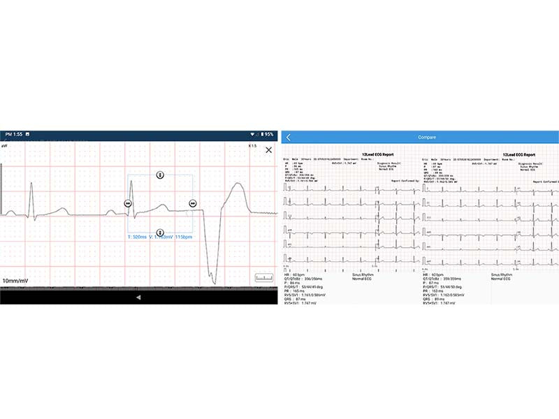 SE-1200 Pro 12-channel Electrocardiograph