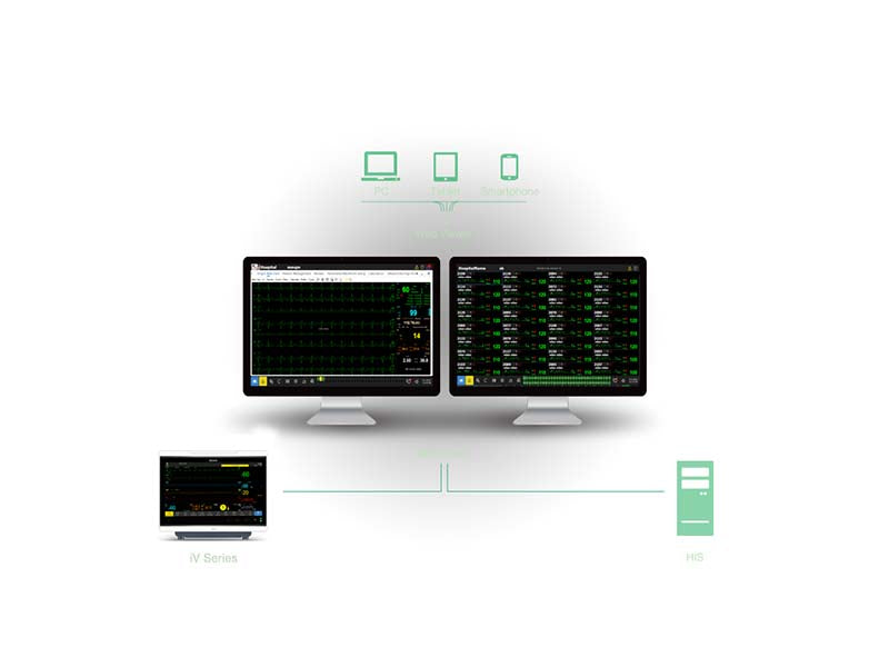 Edan iV 12 Modular Patient Monitors