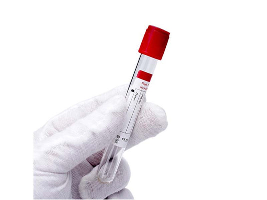 AODEKANG 1-10ml No Additive Plain tube Vacuum Blood Collection Tube (1)