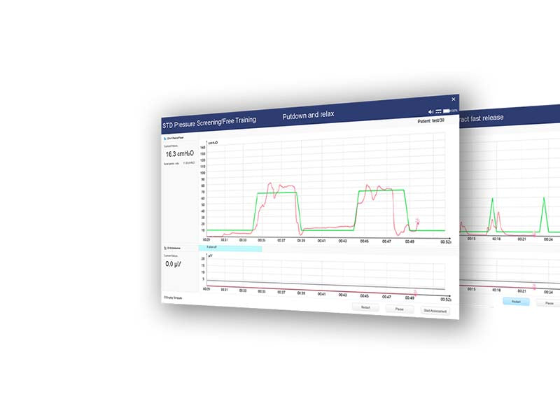 Edan PR Series Biofeedback and stimulation system