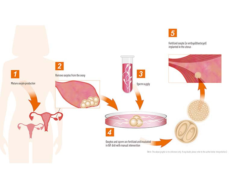 Kangjian IVF 6-Well Dish (1)