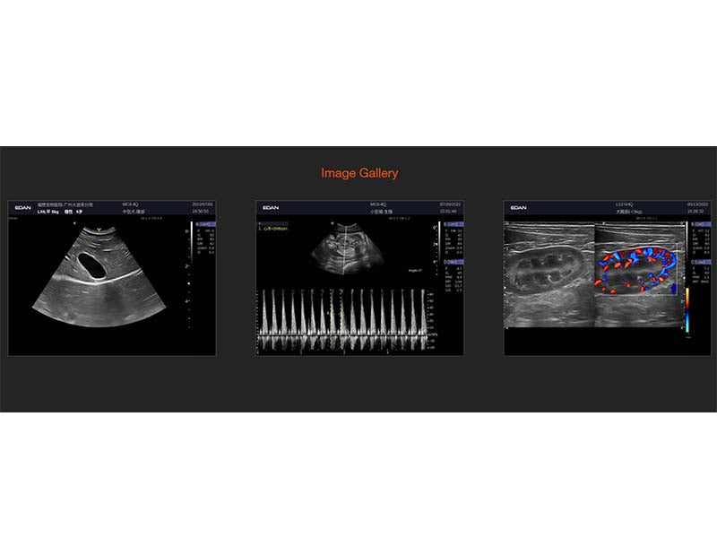 2. Acclarix LX9 VET  Veterinary Cart-based Color Ultrasound (1)