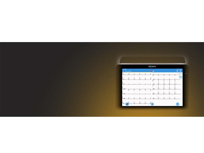 Edan iSE Series 1218-lead Electrocardiograph