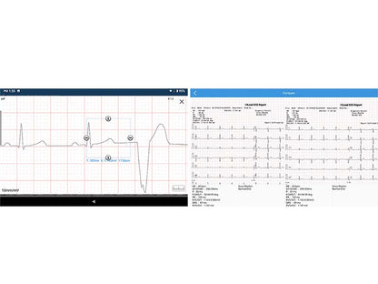 Edan iSE Series 1218-lead Electrocardiograph