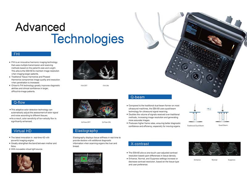 Chison EBit 60 Portable Color Ultrasound