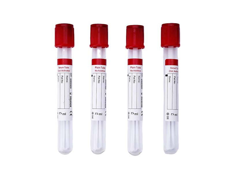 AODEKANG 1-10ml Clot Activator Tube Vacuum Blood Collection Tube (1)