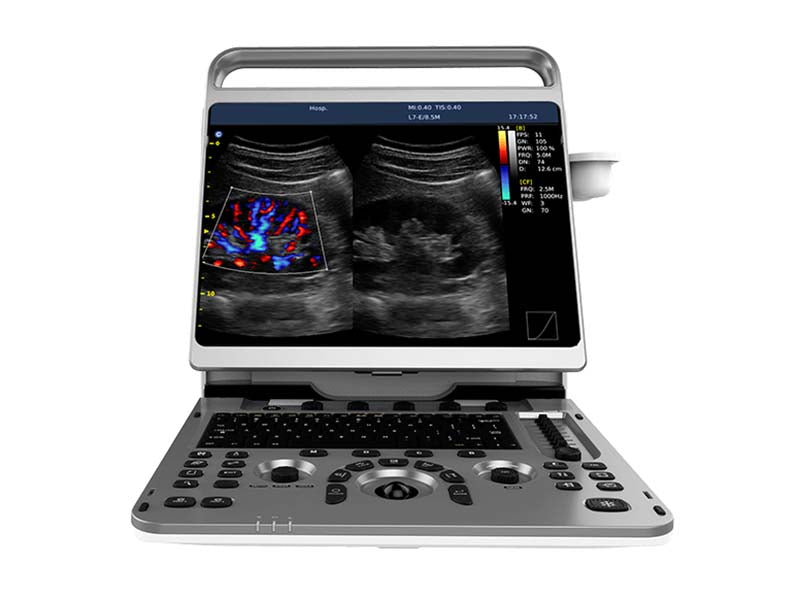 Chison  EBit 50 Portable Color Ultrasound