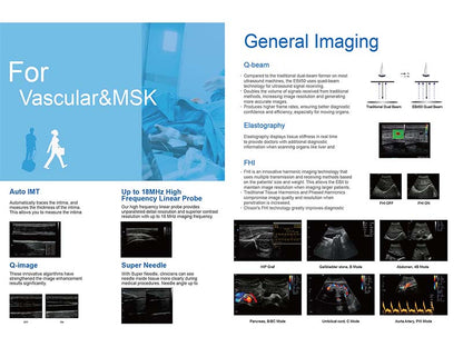 Chison  EBit 50 Portable Color Ultrasound