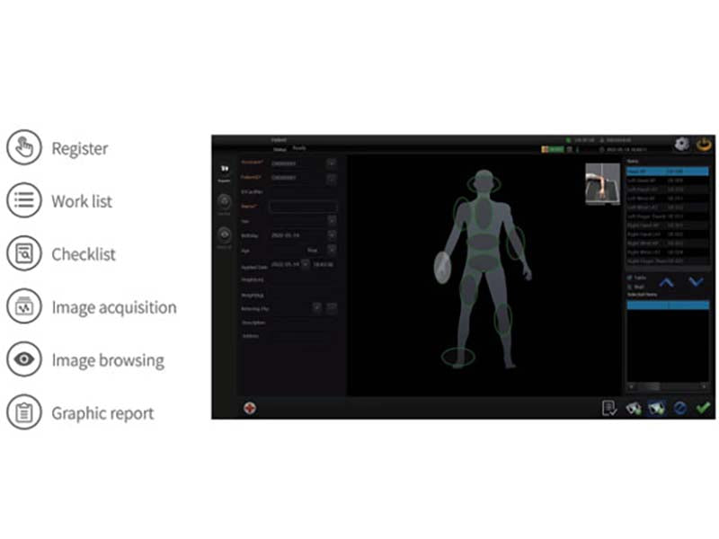 Perlove PLD 3800 Series Vehicle-Mounted Digital Radiography System (1)