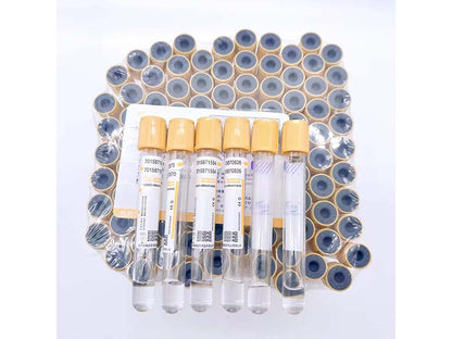 AODEKANG 1-9ml Gel Clot Activator Tube Vacuum Blood Collection Tube (1)