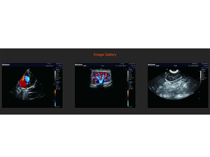 4. Acclarix LX2 VET Veterinary Cart-based Color Ultrasound (1)