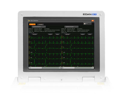 SE-18 18-Lead ECG