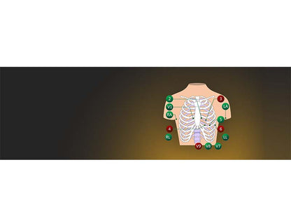 SE-18 18-Lead ECG