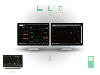 Edan iX Series Compact Patient Monitors