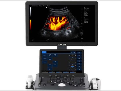 Zoncare ViV20 Cart-based Color Ultrasound