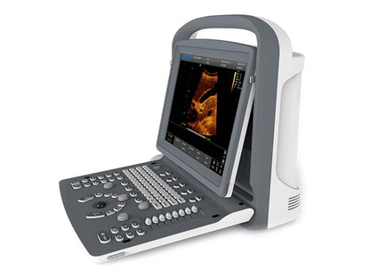 Chison  ECO2 Portable B&W Ultrasound