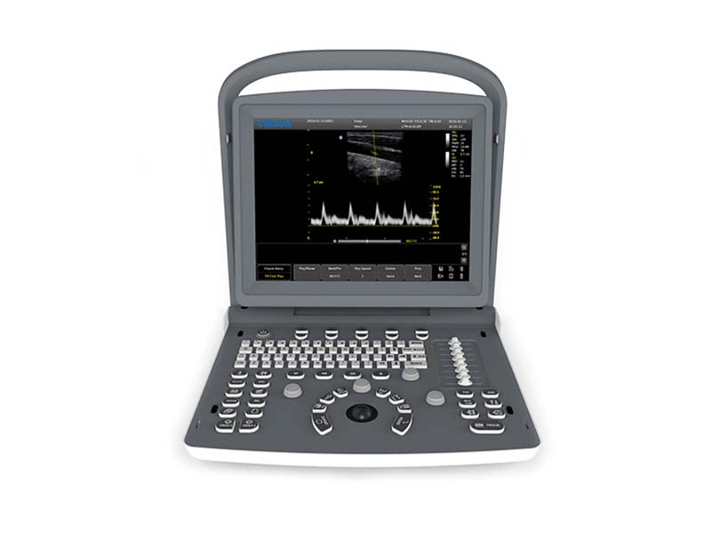 Chison  ECO2 Portable B&W Ultrasound