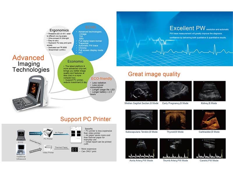 Chison  ECO2 Portable B&W Ultrasound