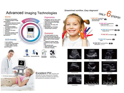 Chison  ECO 3 EXPERT Portable B&W Ultrasound