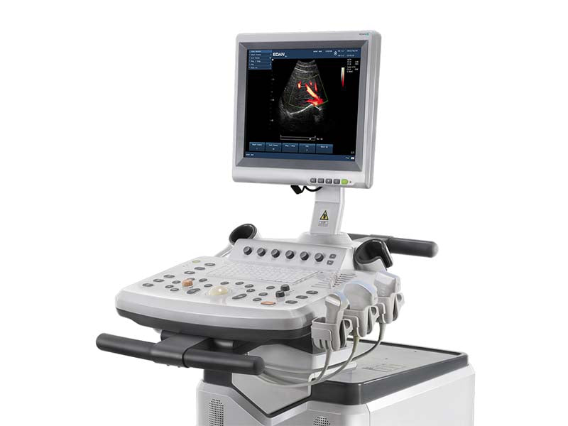 Edan U2 Cart-Based Color Doppler Ultrasound