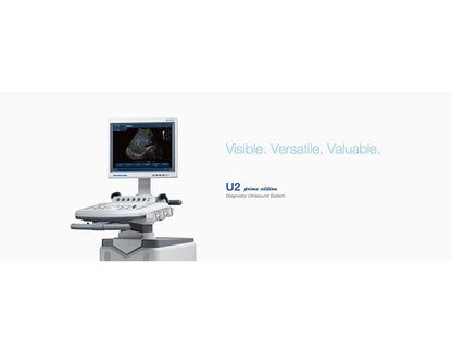 Edan U2 Cart-Based Color Doppler Ultrasound