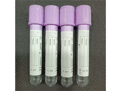 AODEKANG 1-10ml EDTA Tube Vacuum Blood Collection Tube (1)