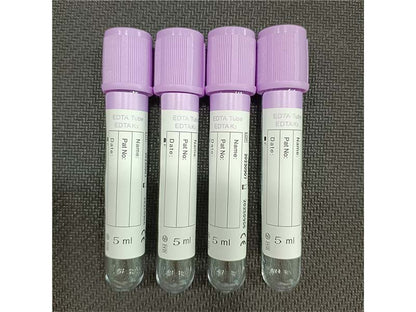 AODEKANG 1-10ml EDTA Tube Vacuum Blood Collection Tube (1)