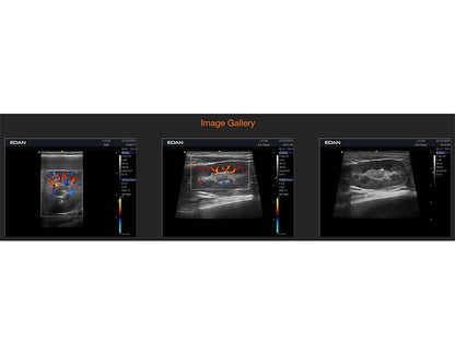 5. Acclarix AX8 VET Veterinary Portable Ultrasound (1)