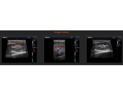 7. Acclarix AX2 VET Veterinary Portable Ultrasound (1)