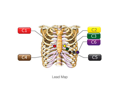 SE-301 Series Portable Multi-Channel ECG