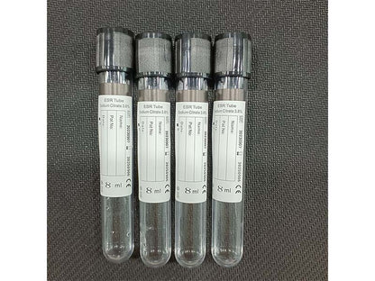 AODEKANG 1-10ml Sodium Citrate 3.8% ESR Tube Vacuum Blood Collection Tube (1)