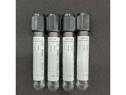 AODEKANG 1-10ml Sodium Citrate 3.8% ESR Tube Vacuum Blood Collection Tube (1)