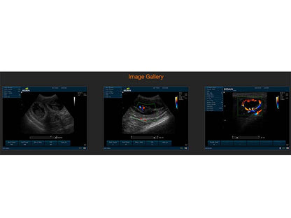 8. U2 VET Veterinary Cart-based Color Ultrasound (1)