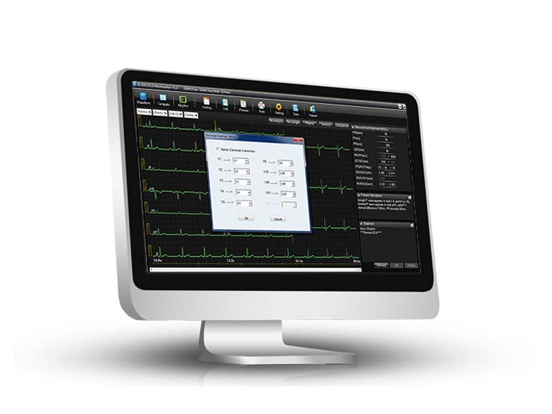 SE-1515 ECG Workstation