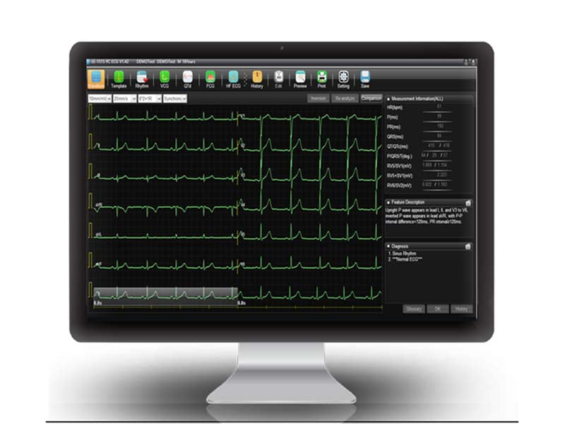 SE-1515 ECG Workstation