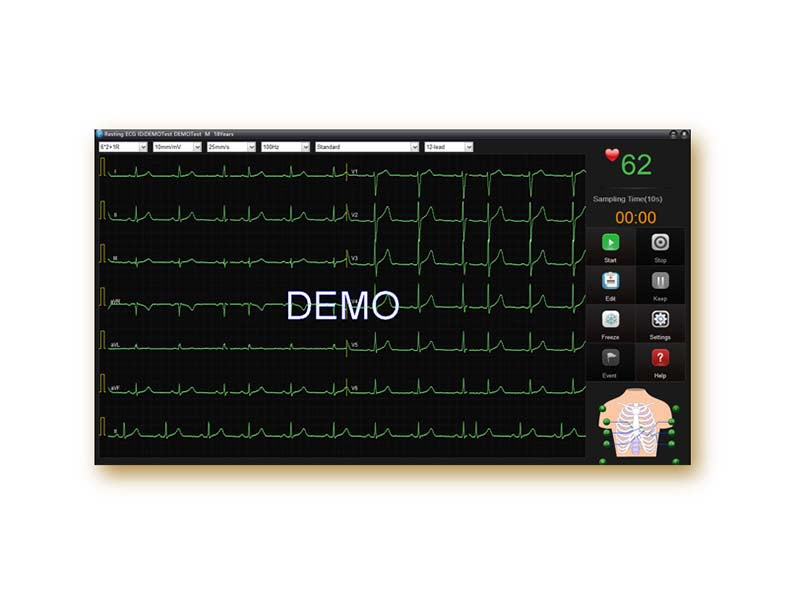 SE-1515 ECG Workstation