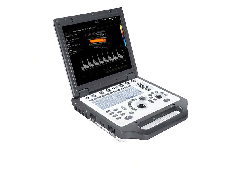 G30 Color Doppler Diagnostic Ultrasound